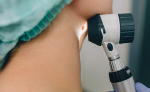 Dermatoskopija Kozne Promjene Na Vratu