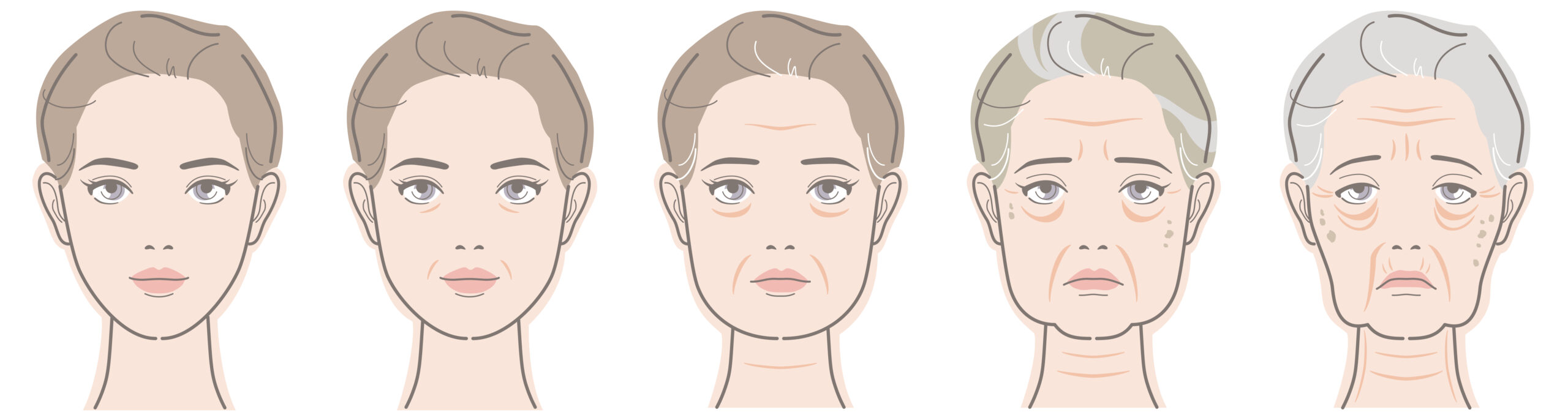 Aging promjene na licu i vratu